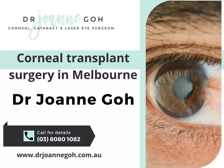 corneal transplant surgery in melbourne dr joanne