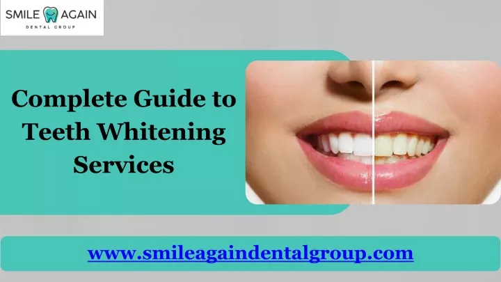 complete guide to teeth whitening services