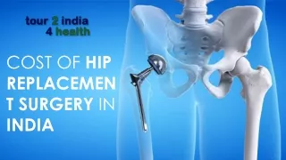 Cost of Hip Replacement Surgery India