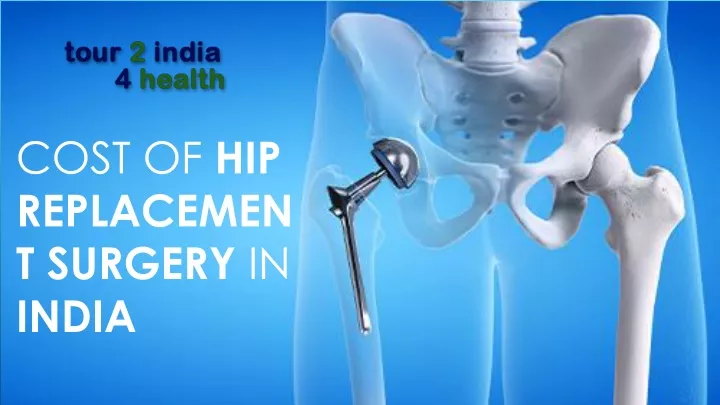 cost of hip replacement surgery in india