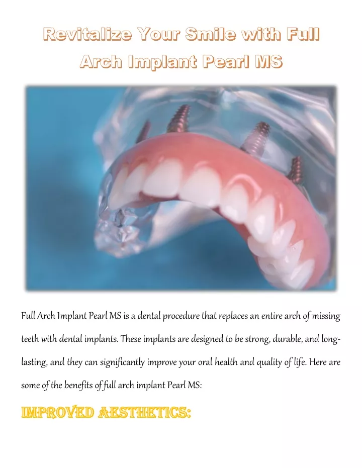 full arch implant pearl ms is a dental procedure