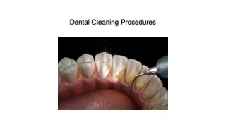 The Importance of Dental Cleaning: Procedures and Techniques