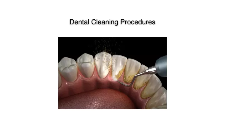 dental cleaning procedures