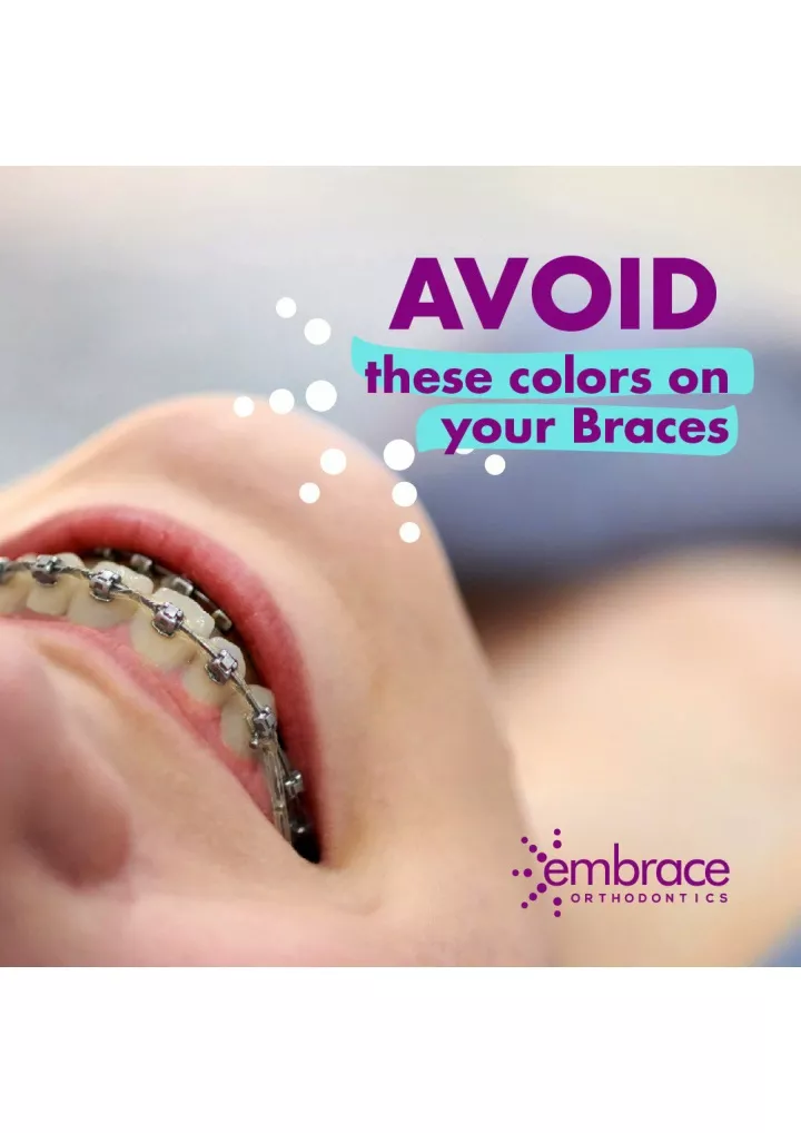 PPT Metal Braces in Mumbai Embrace Orthodontics PowerPoint