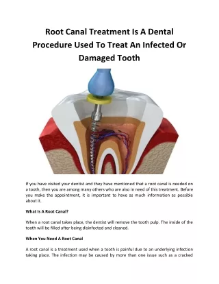 Root Canal Treatment Is A Dental Procedure Used To Treat An Infected Or Damaged Tooth