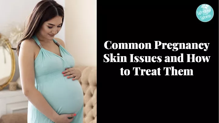 common pregnancy skin issues and how to treat