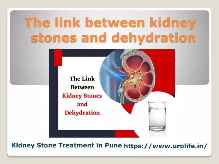 the link between kidney stones and dehydration