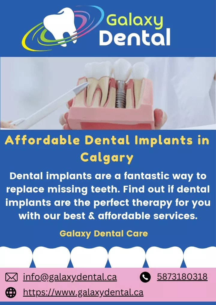affordable dental implants in calgary dental