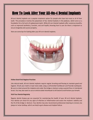 How To Look After Your All-On-4 Dental Implants