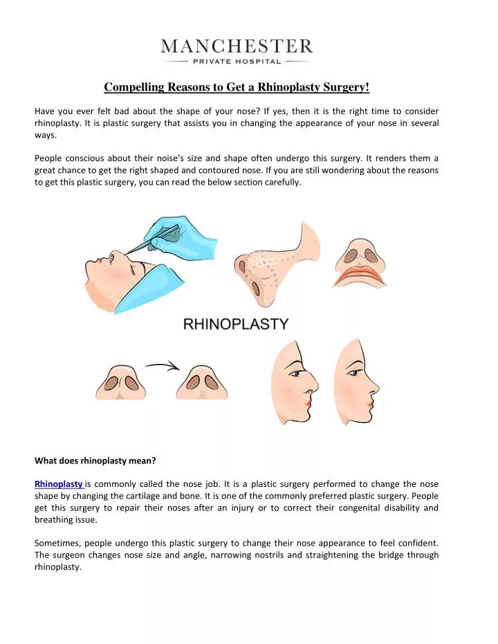 compelling reasons to get a rhinoplasty surgery