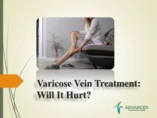Varicose Vein Treatment - Will It Hurt?