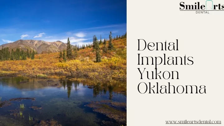 dental implants yukon oklahoma