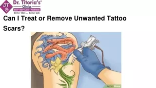 Can I Treat or Remove Unwanted Tattoo Scars_