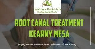 Understanding Root Canal Treatment Kearny Mesa: What You Need to Know