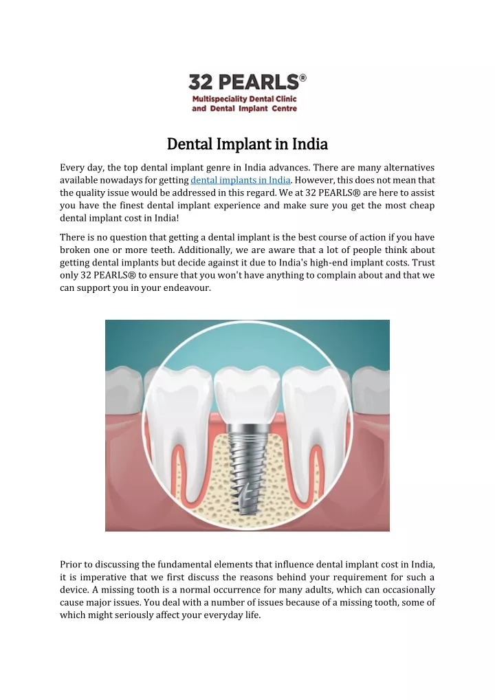 Ppt Best Dental Implant In India Powerpoint Presentation Free Download Id