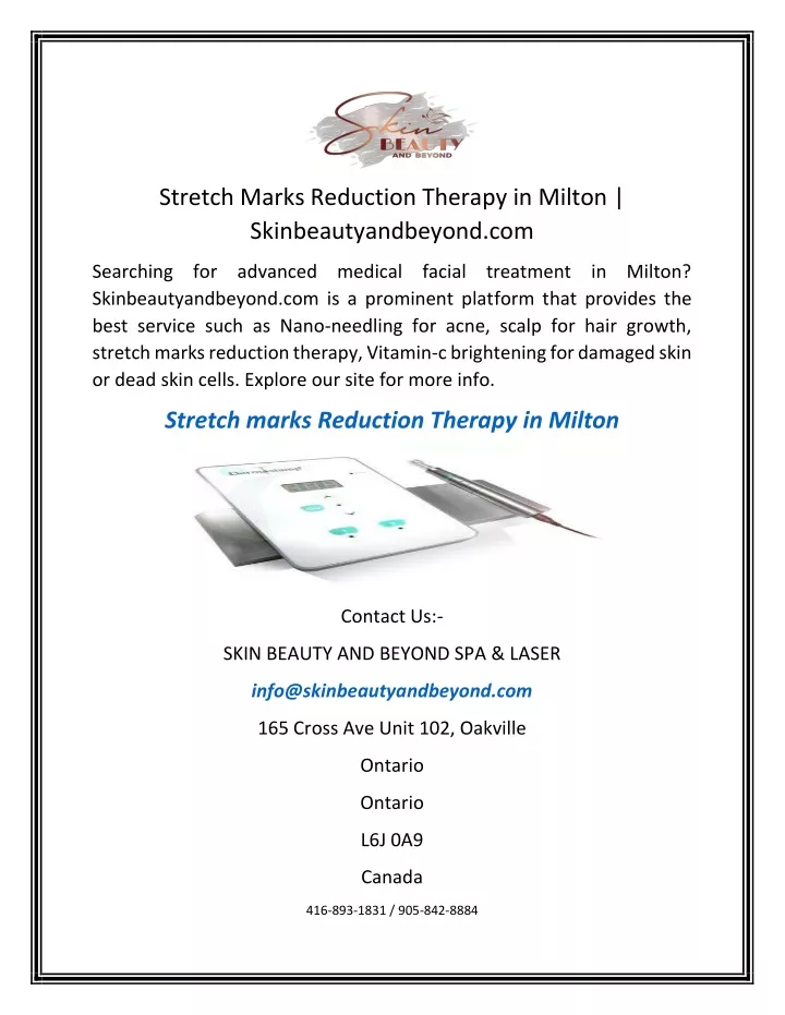 stretch marks reduction therapy in milton