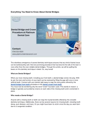 Everything You Need to Know About Dental Bridges