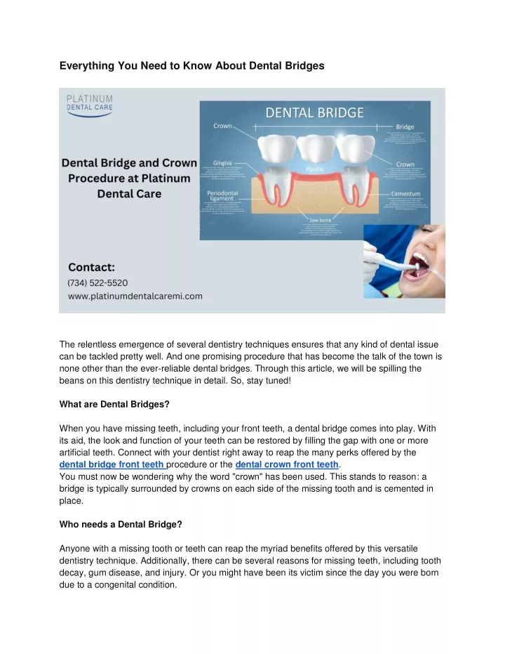 everything you need to know about dental bridges