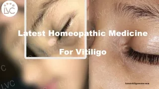 Latest Homeopathic Medicine For Vitiligo