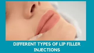 different types of lip filler injections