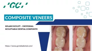 composite veneers