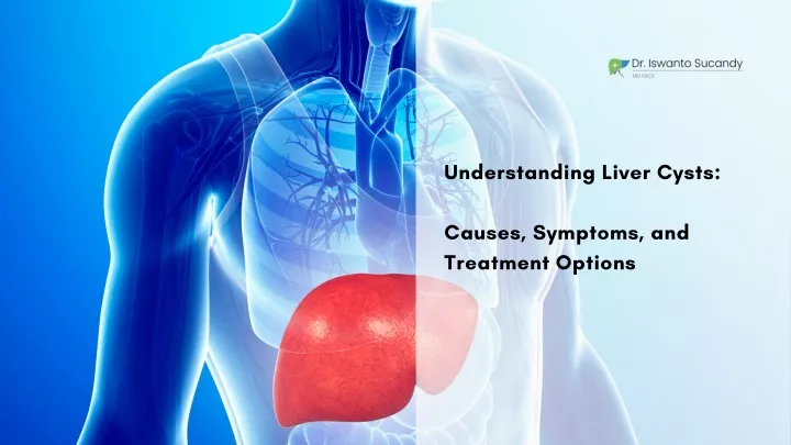 understanding liver cysts