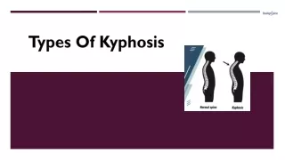 types of kyphosis