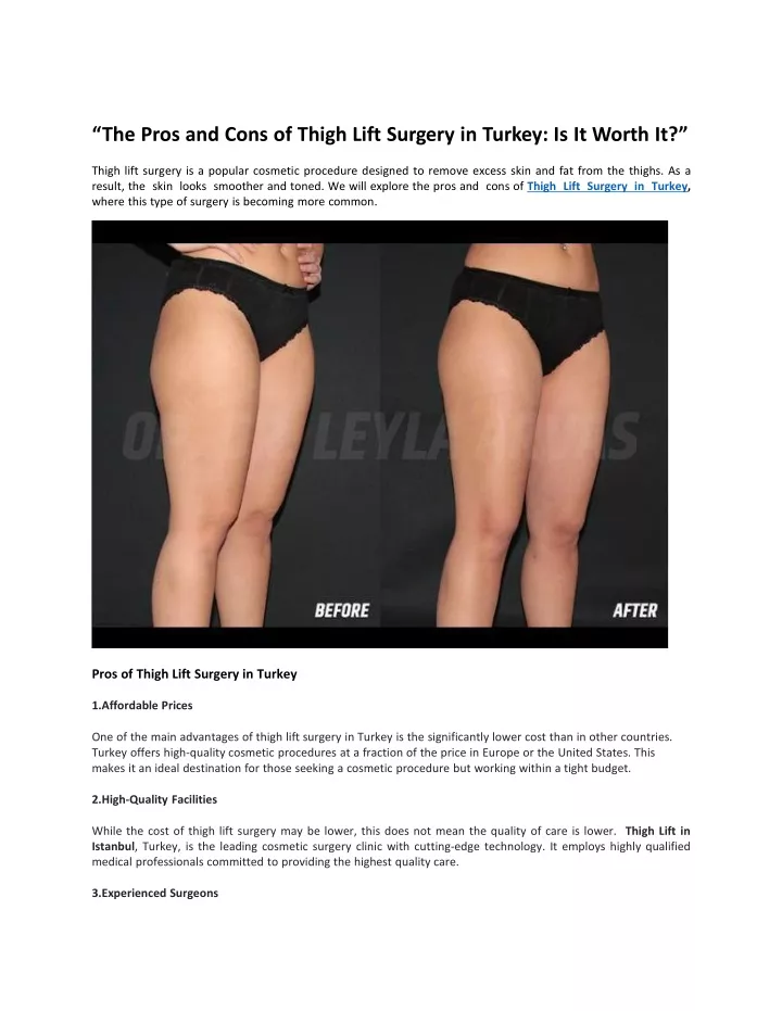 the pros and cons of thigh lift surgery in turkey