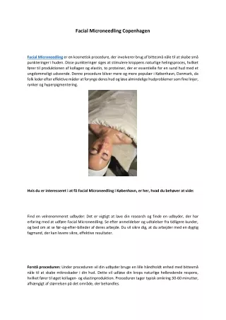 Facial Microneedling Copenhagen