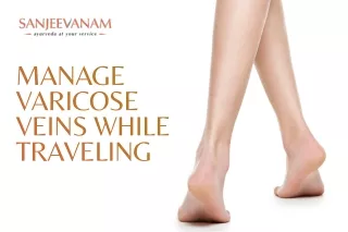 Manage Varicose Veins While Traveling