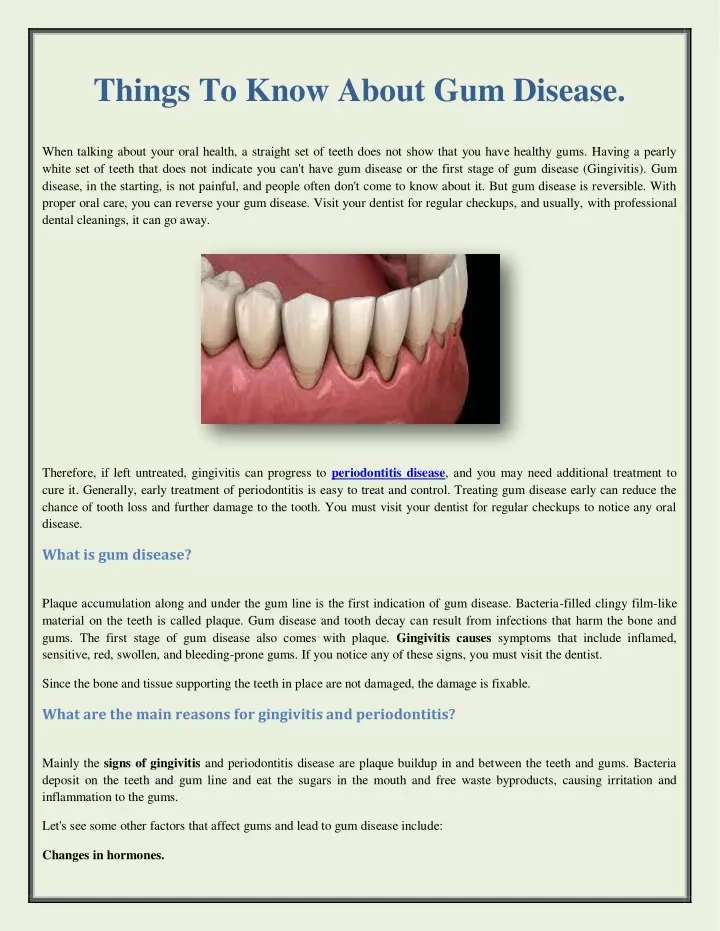 things to know about gum disease